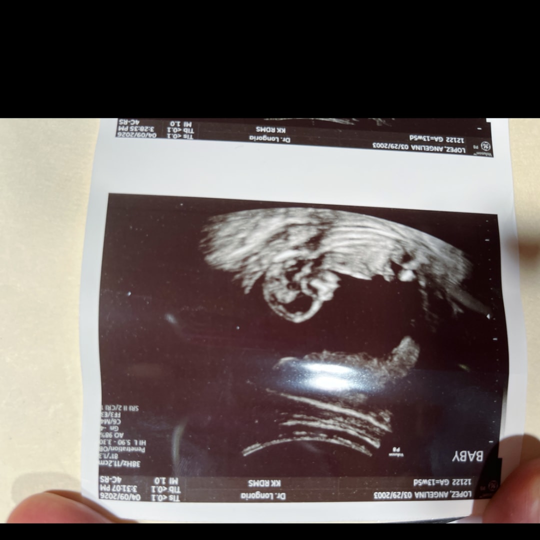 Photo shared by Angelina for their Babylist baby registry.