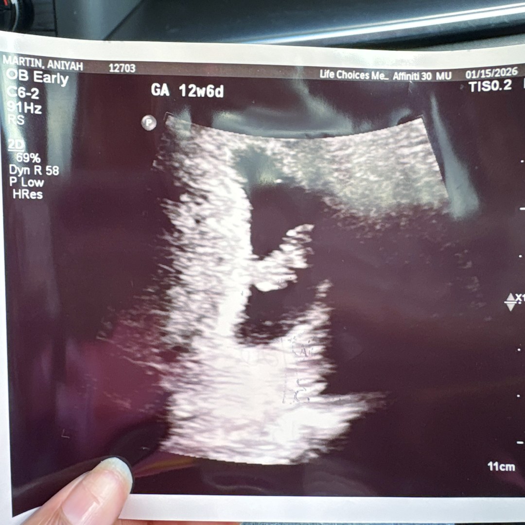 Photo shared by Niyah for their Babylist baby registry.