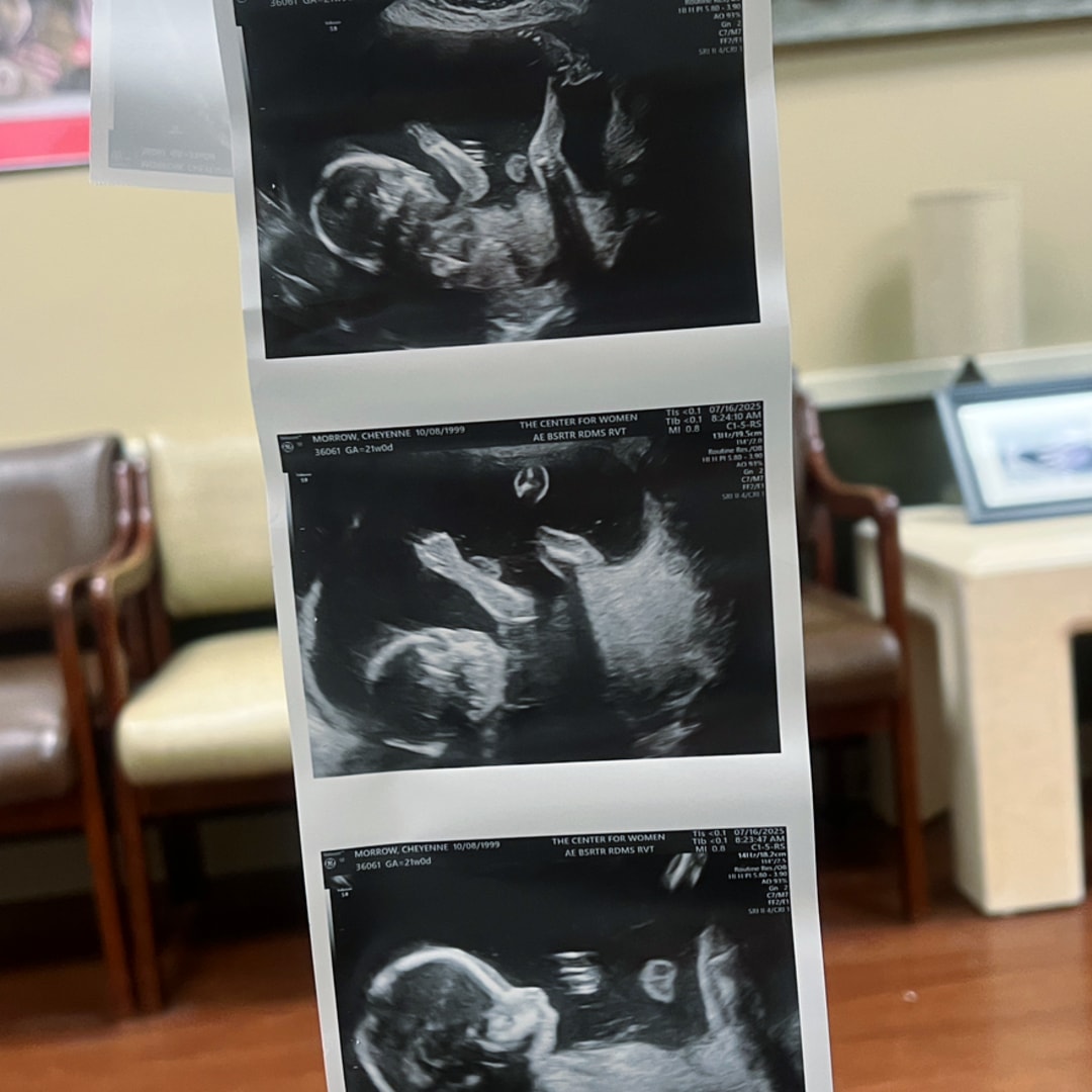 Photo shared by Cheyenne for their Babylist baby registry.