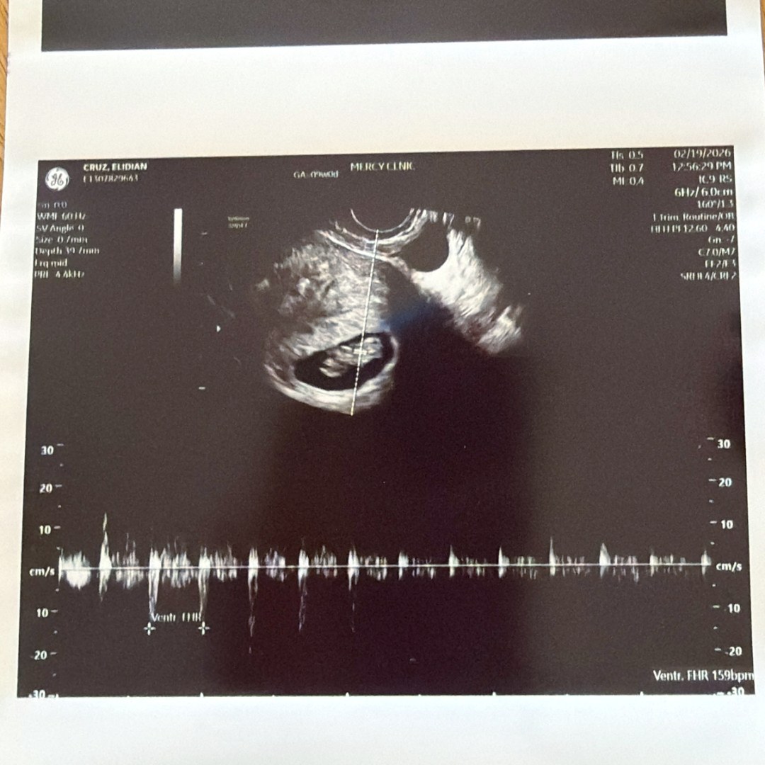 Photo shared by Elidia for their Babylist baby registry.