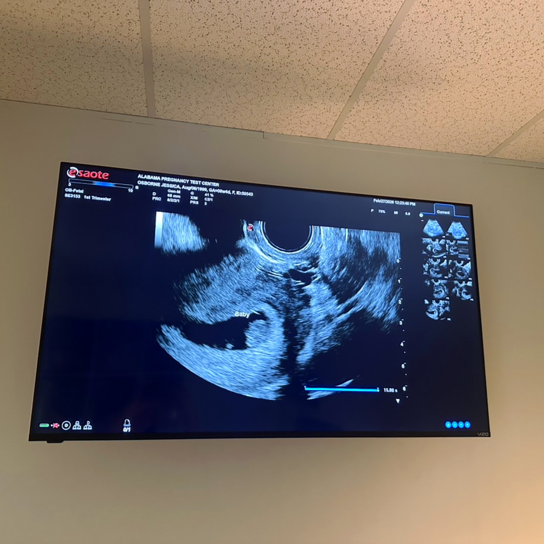 Photo shared by Jess for their Babylist baby registry.