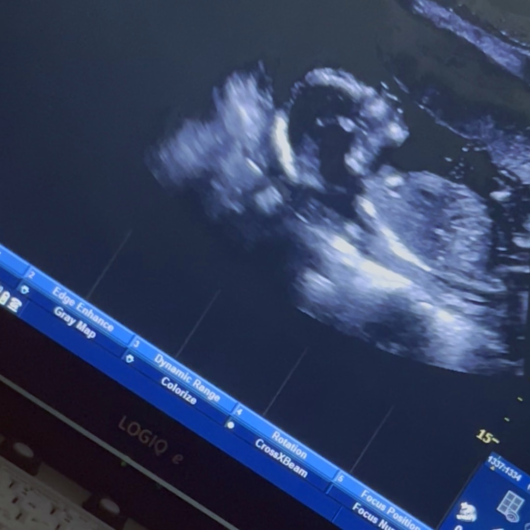 Photo shared by Shatoria for their Babylist baby registry.