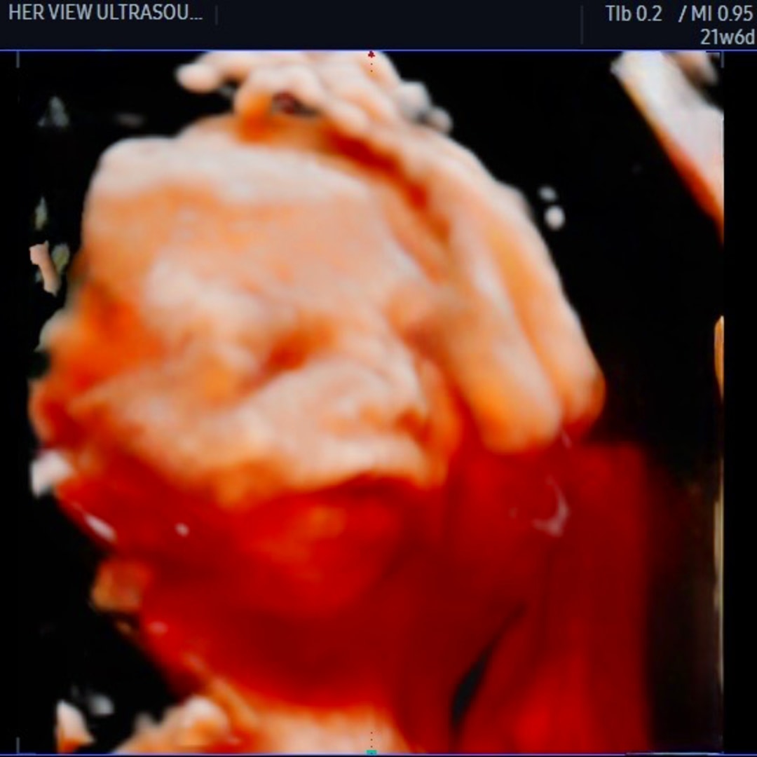 Photo shared by Bobby for their Babylist baby registry.