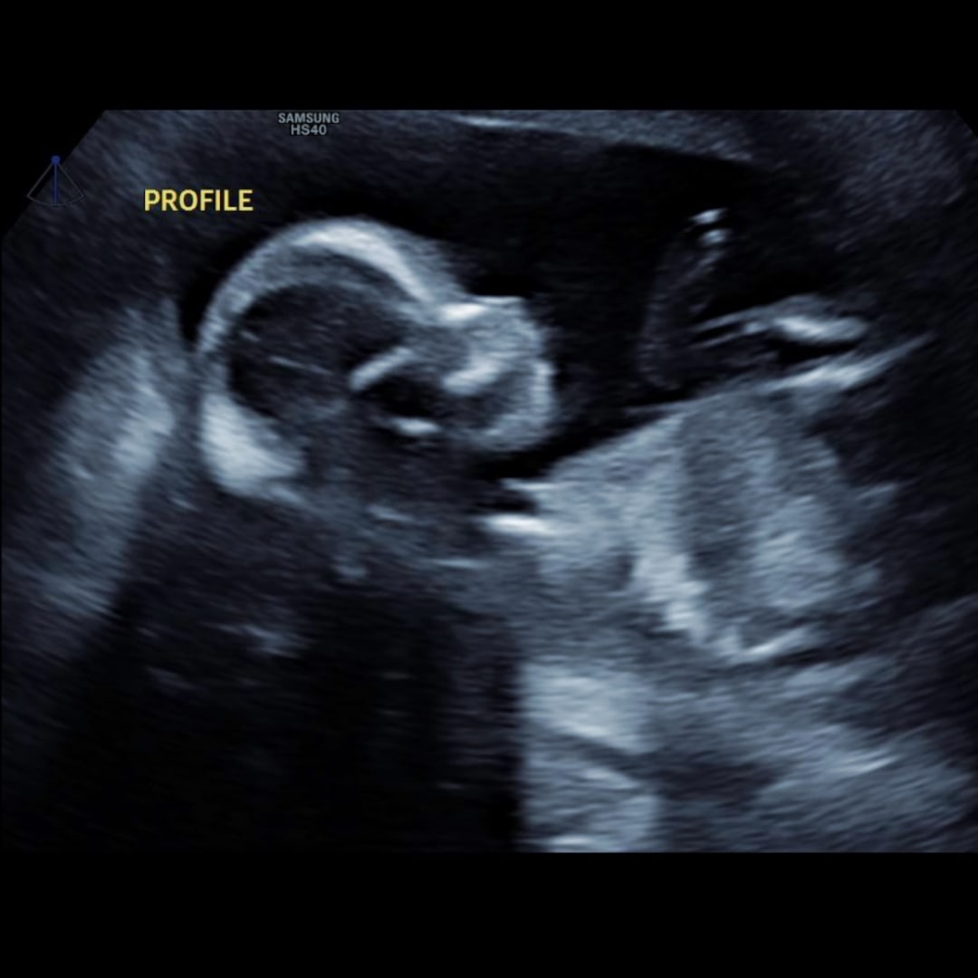 Photo shared by Kaley for their Babylist baby registry.