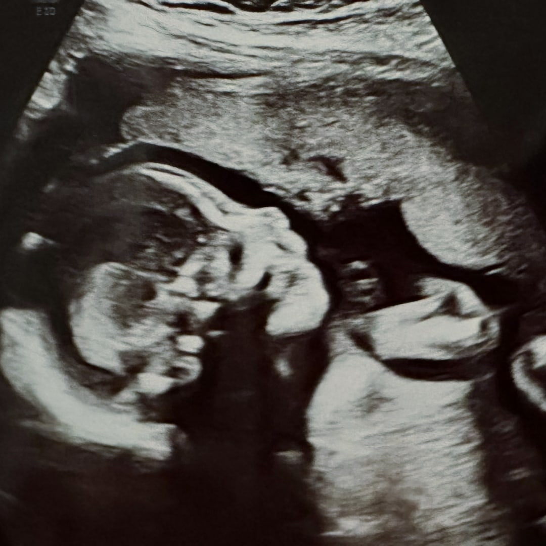 Photo shared by Lauren for their Babylist baby registry.
