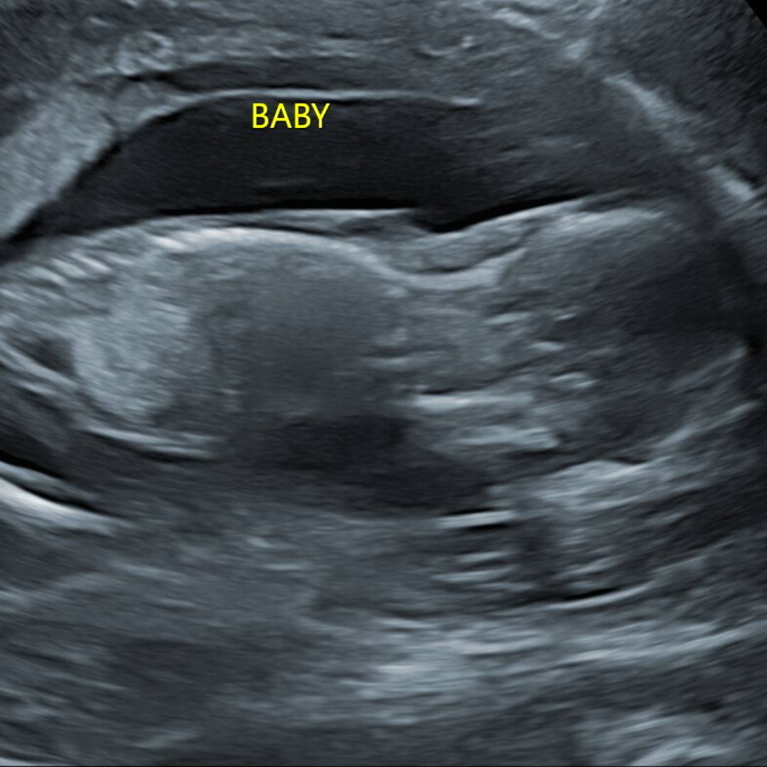 Photo shared by Nancy for their Babylist baby registry.