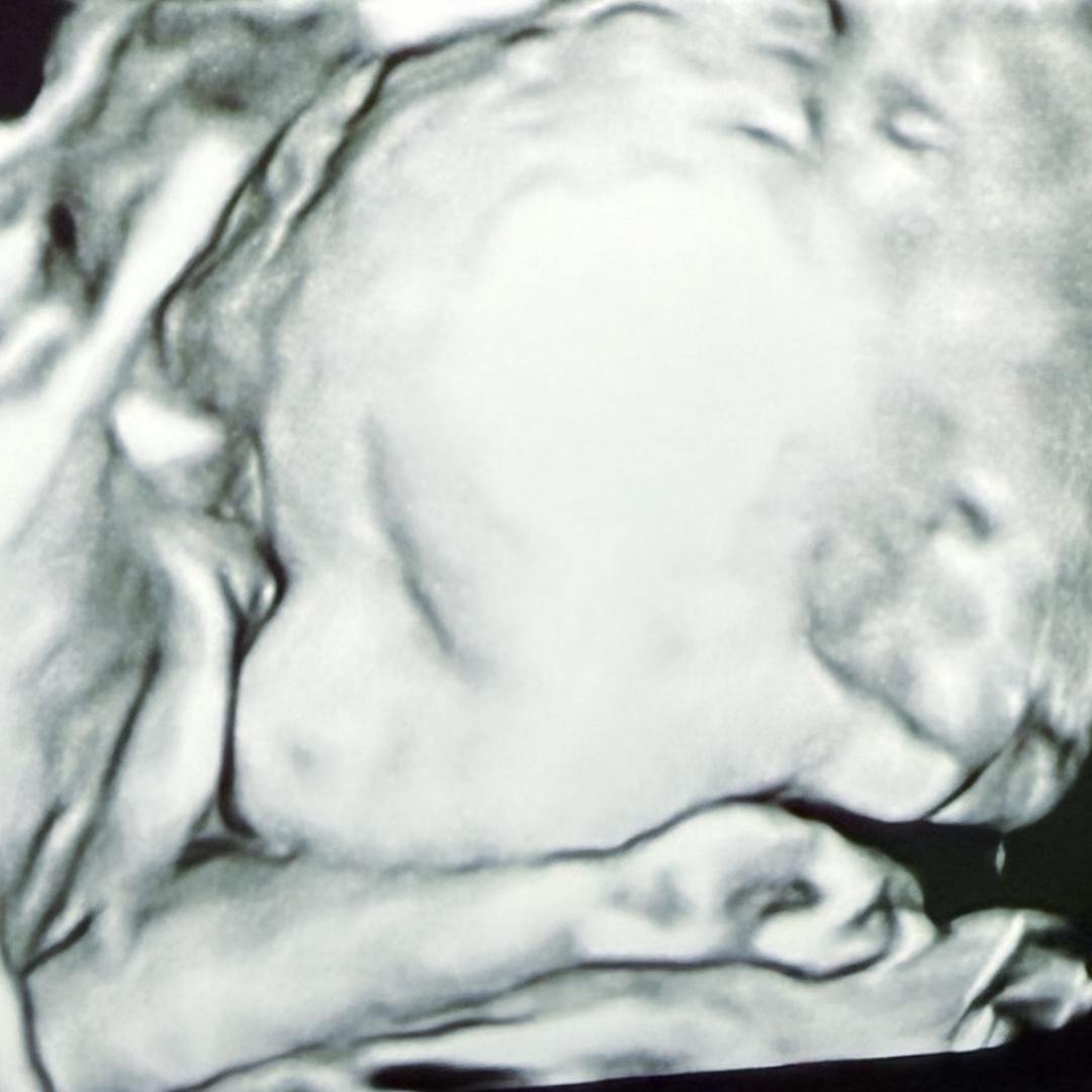 Photo shared by Megan for their Babylist baby registry.