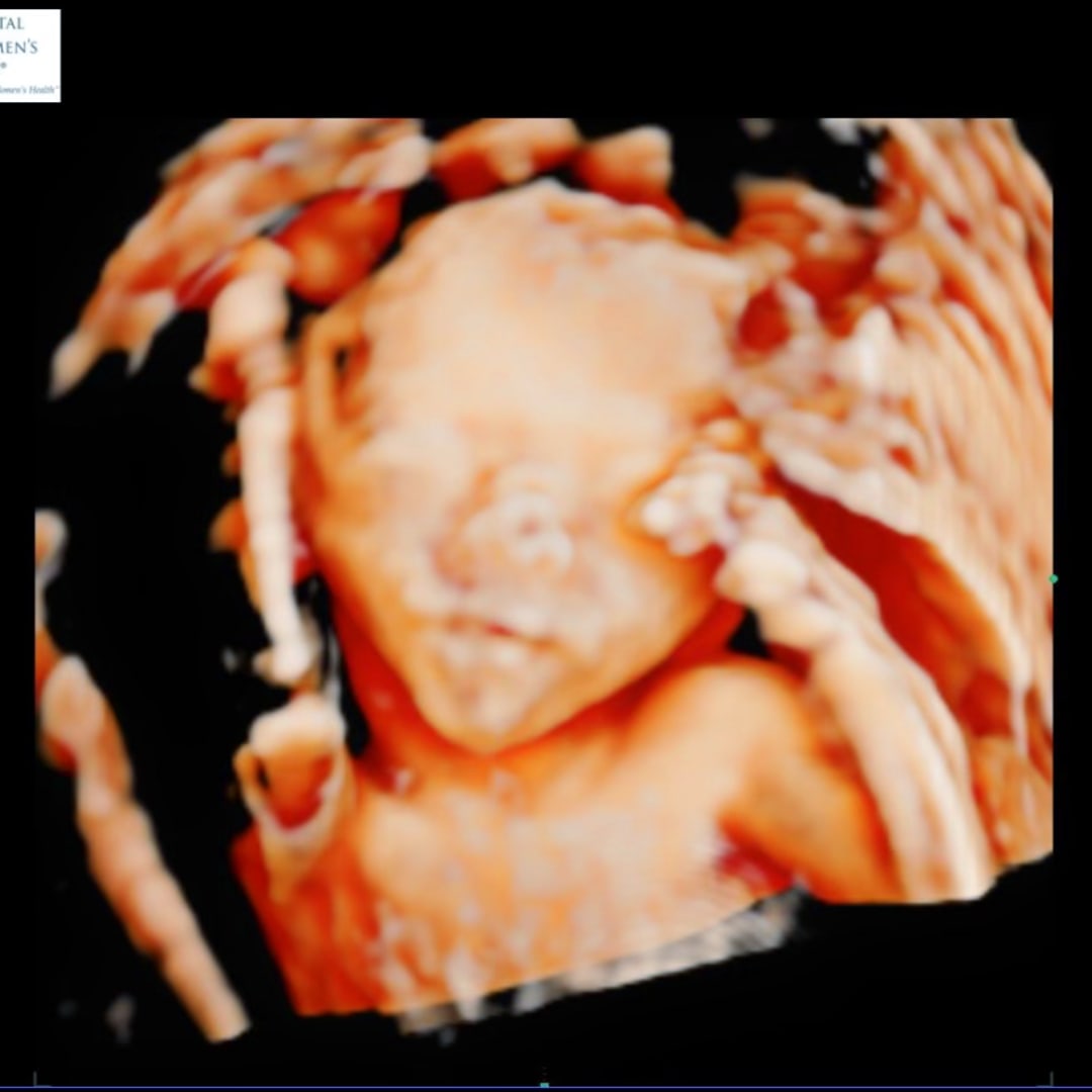 Photo shared by Promise for their Babylist baby registry.