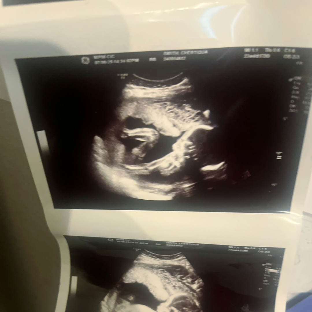 Photo shared by Chertiqua for their Babylist baby registry.