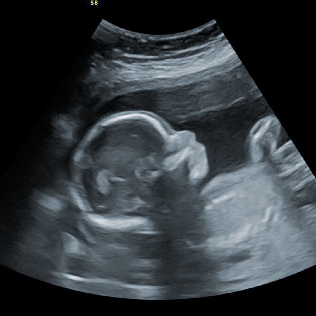 Photo shared by Elizabeth for their Babylist baby registry.