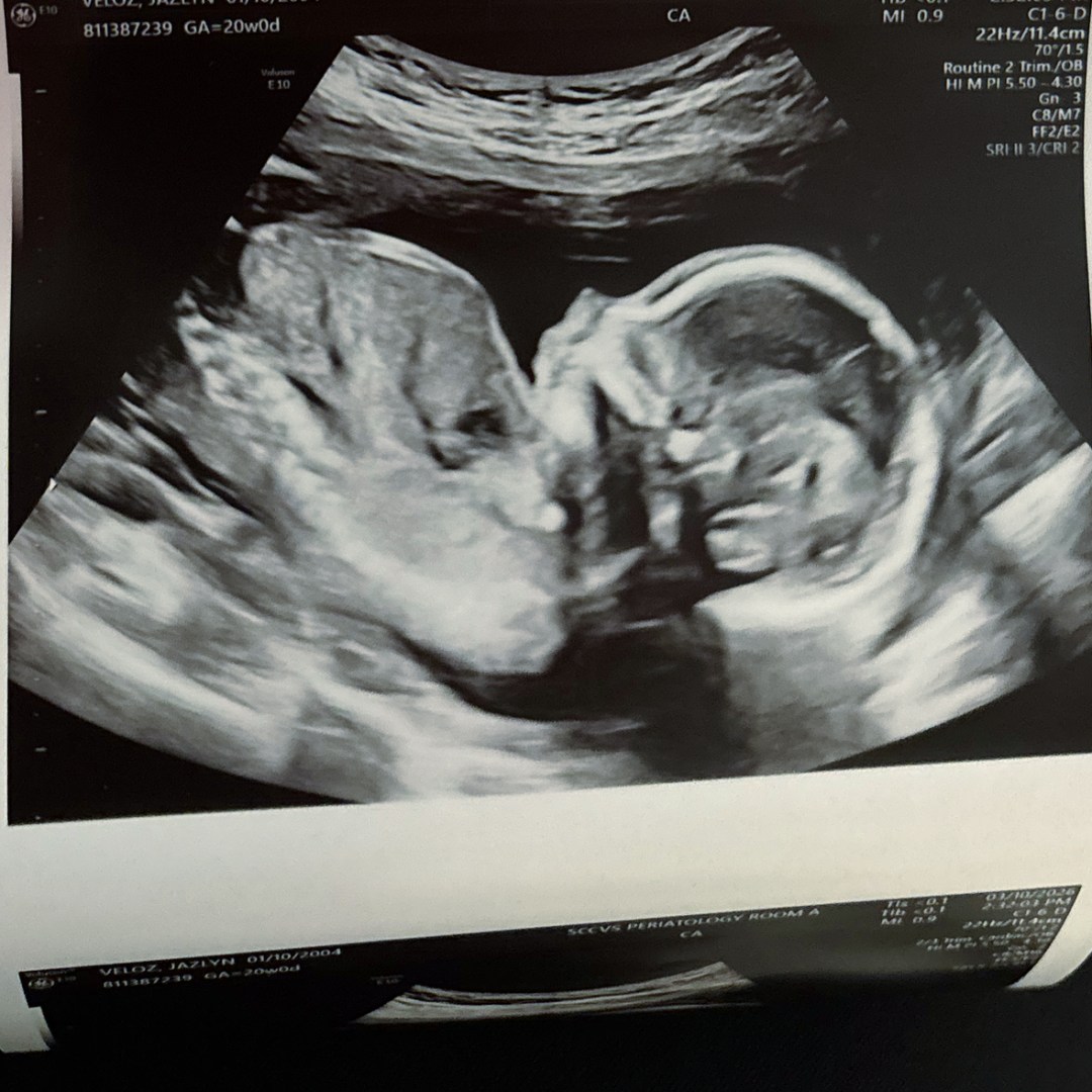 Photo shared by Jazlyn for their Babylist baby registry.