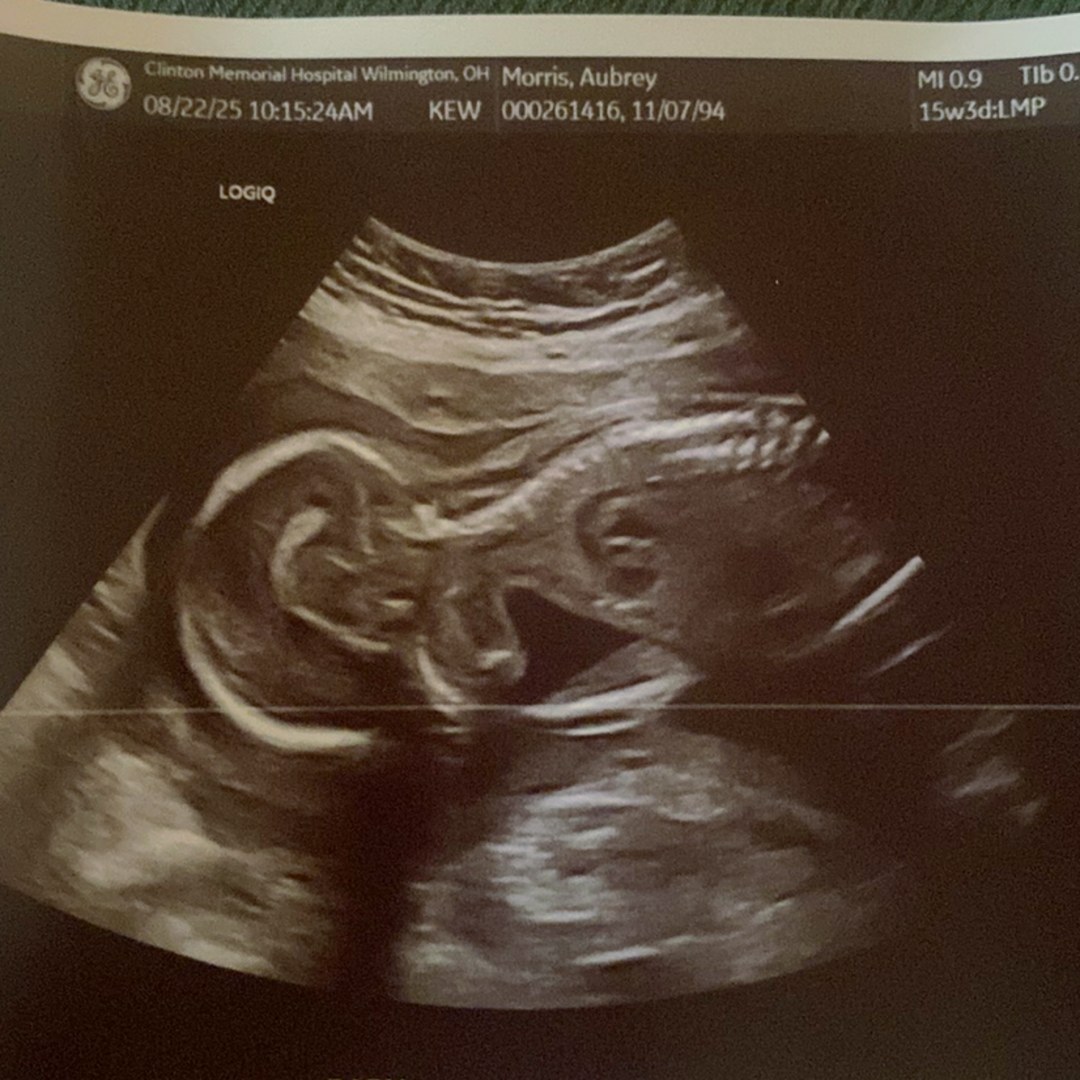 Photo shared by Aubrey for their Babylist baby registry.