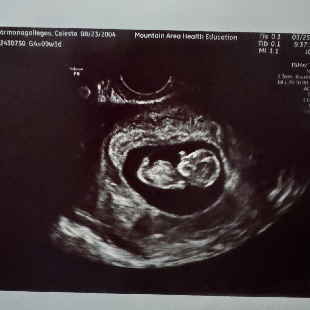 Photo shared by Celeste for their Babylist baby registry.