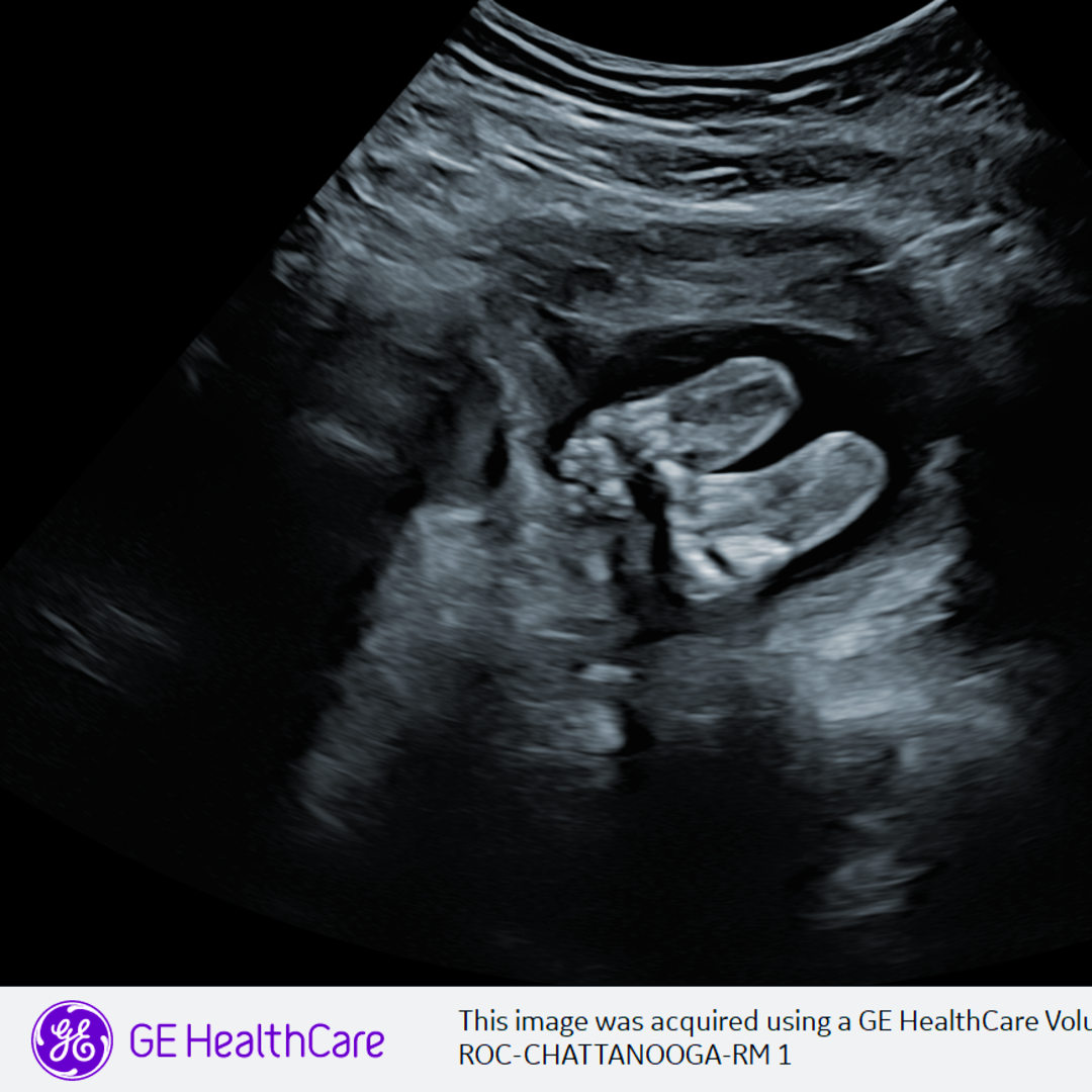 Photo shared by Carly for their Babylist baby registry.