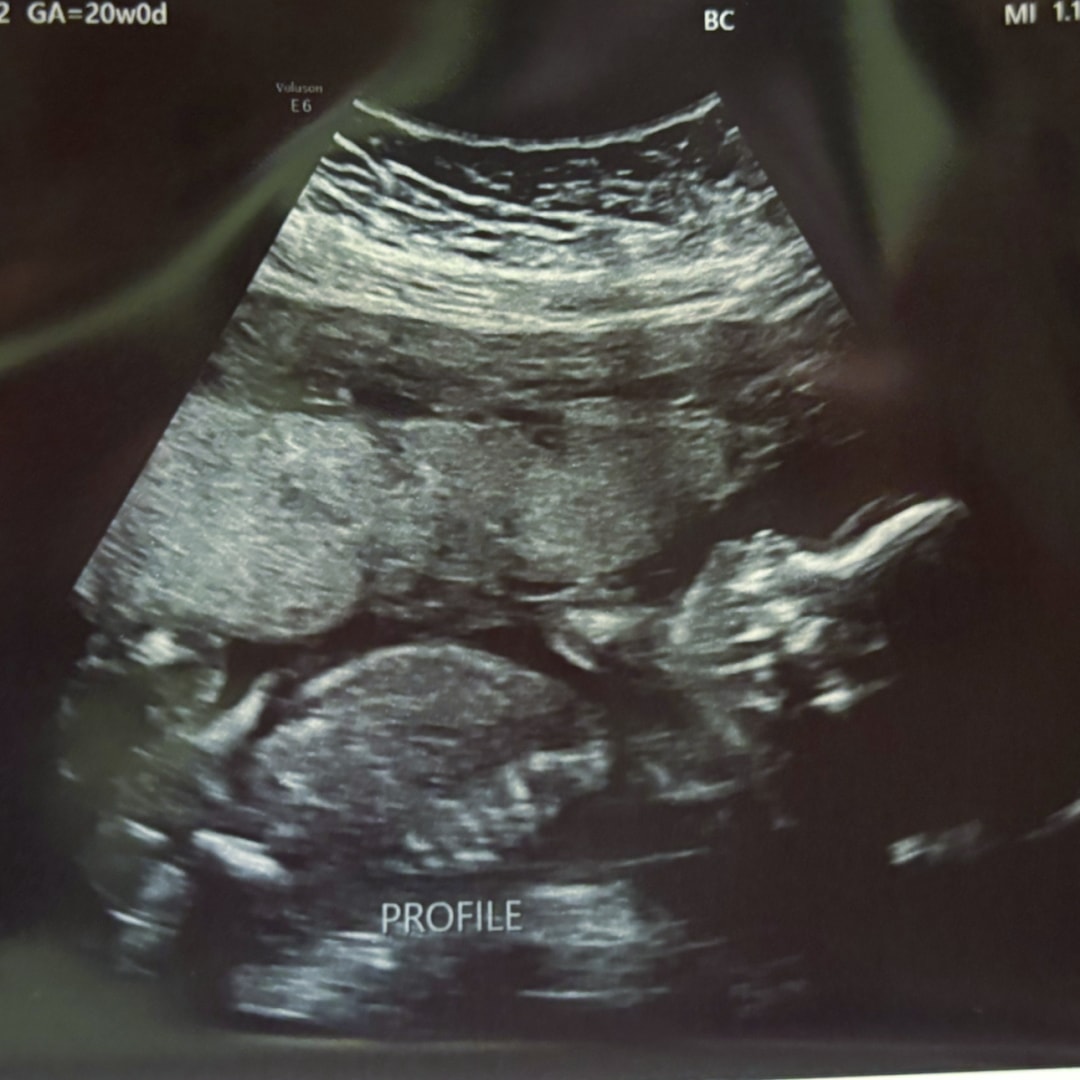 Photo shared by Kaydance for their Babylist baby registry.