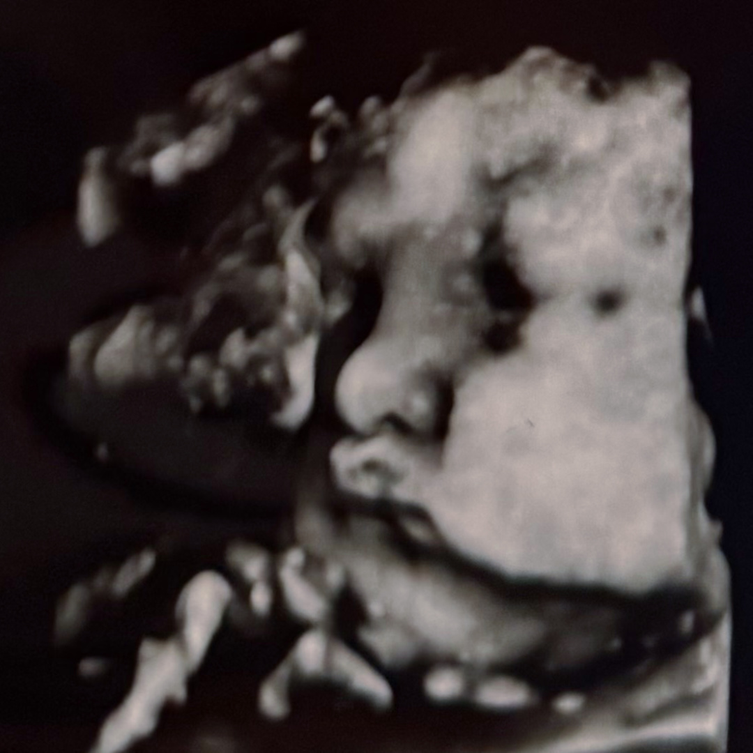 Photo shared by Mia for their Babylist baby registry.