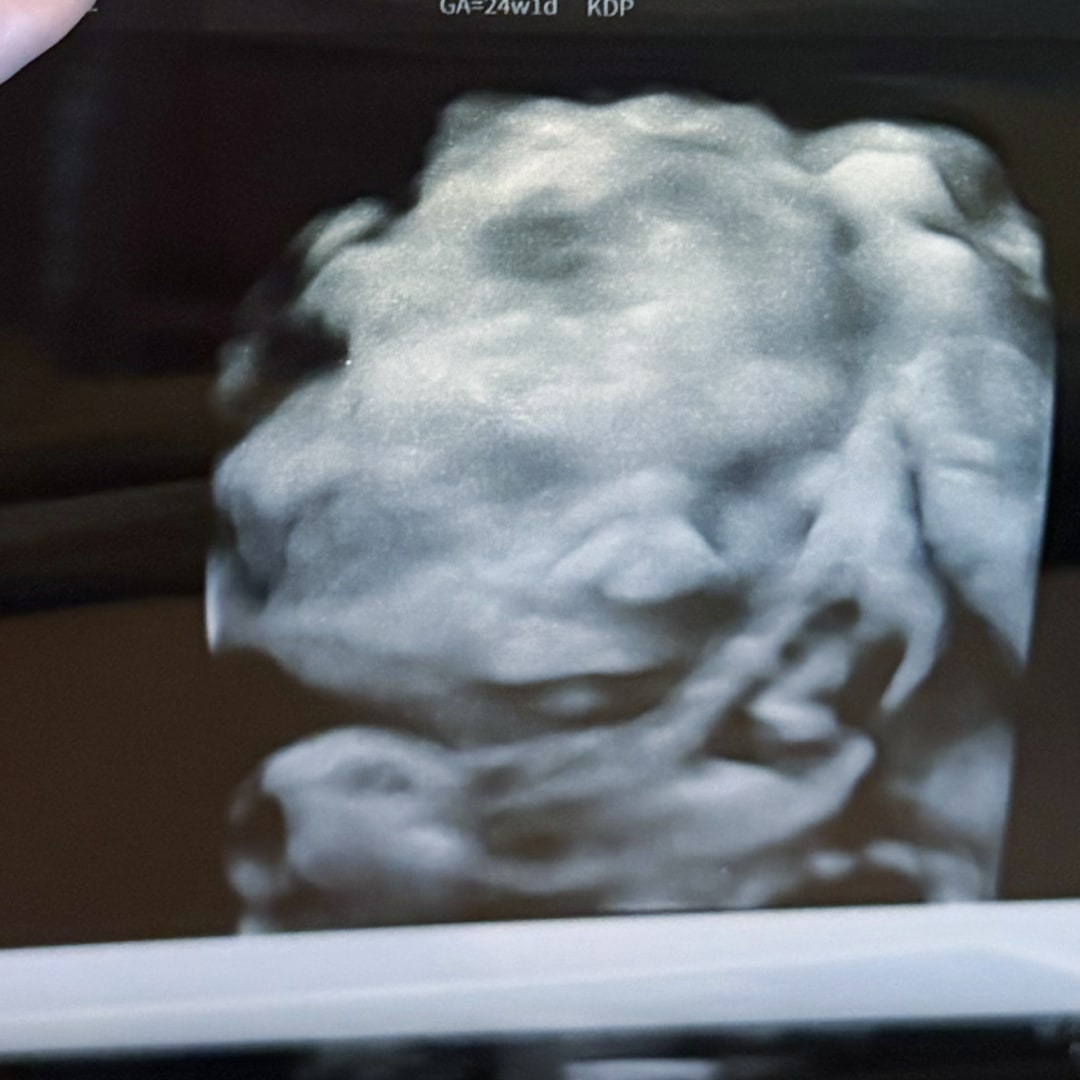 Photo shared by Ceyra for their Babylist baby registry.