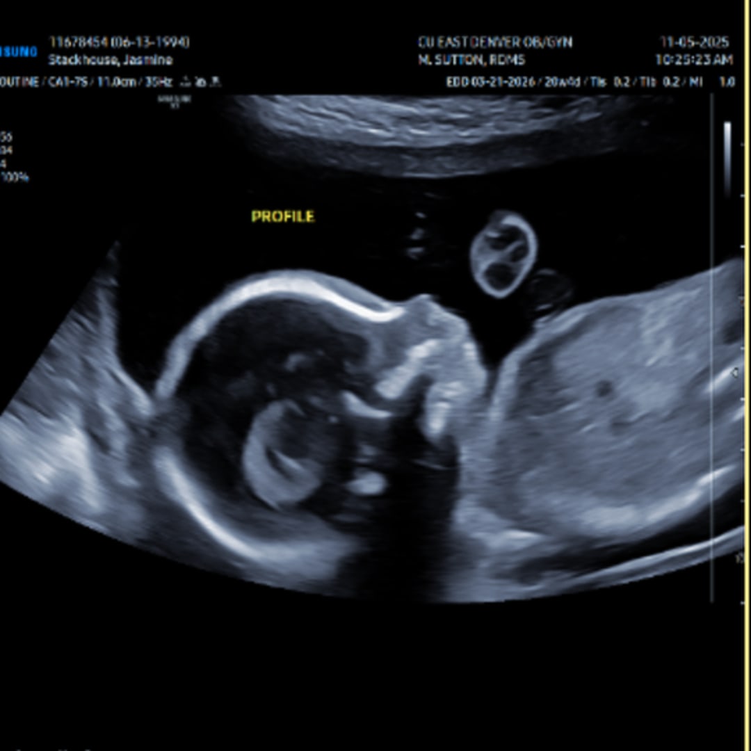 Photo shared by Jasmine for their Babylist baby registry.