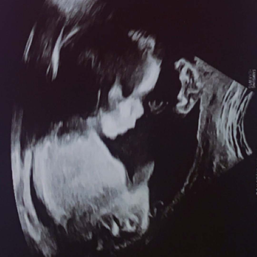 Photo shared by TeKerra for their Babylist baby registry.