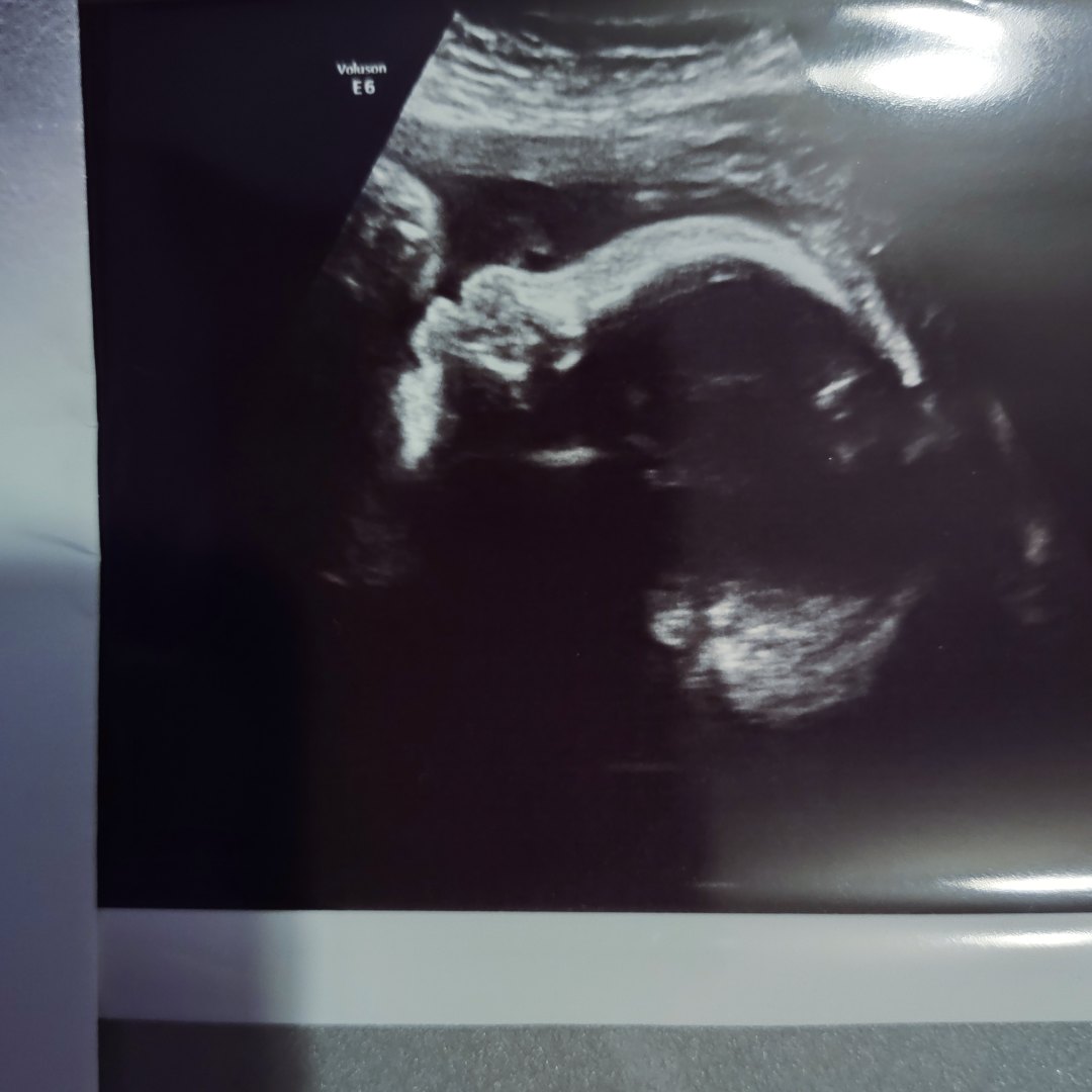 Photo shared by Krystle for their Babylist baby registry.