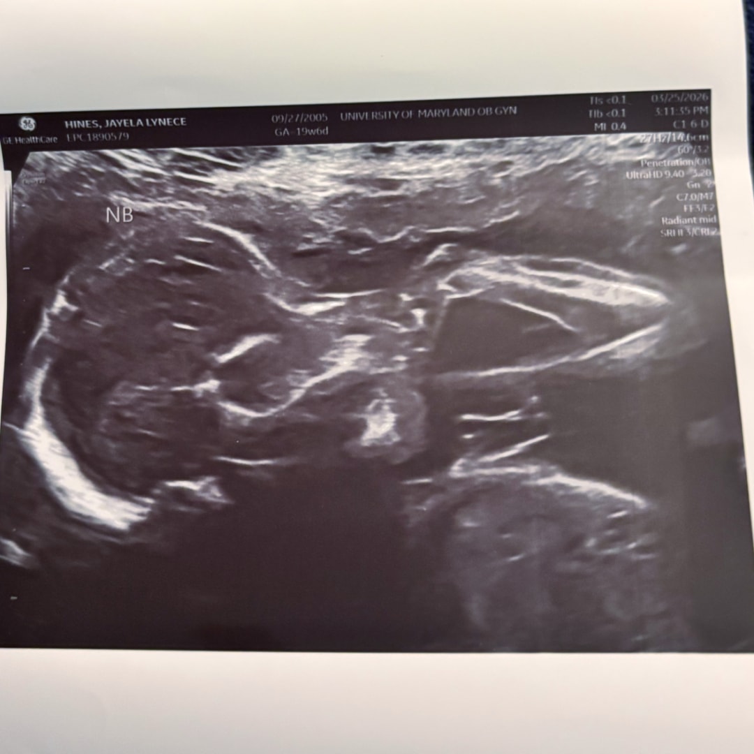 Photo shared by Jayela for their Babylist baby registry.
