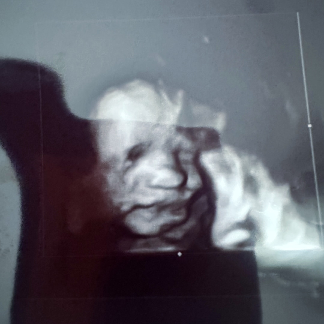 Photo shared by RayeAnne for their Babylist baby registry.
