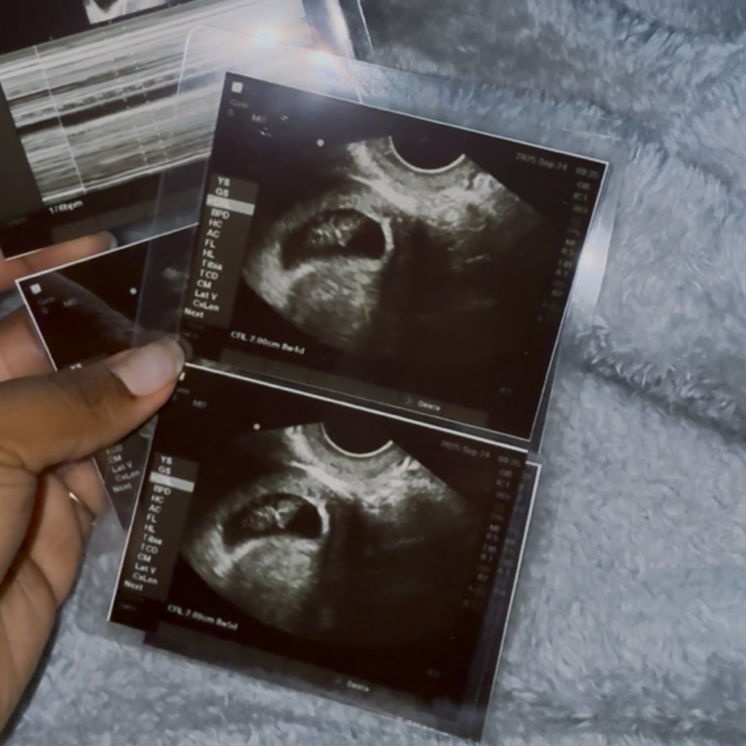 Photo shared by Kannessa for their Babylist baby registry.