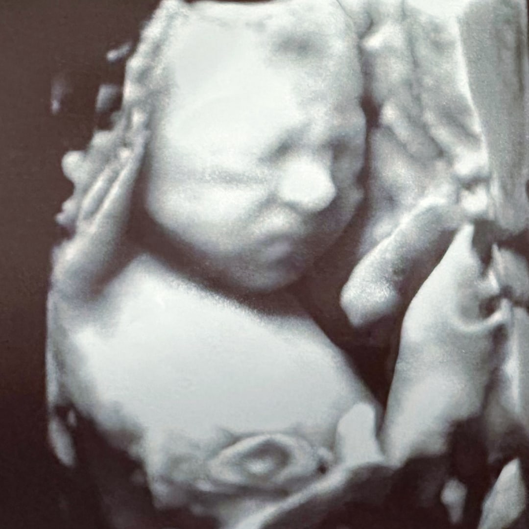 Photo shared by Natalia for their Babylist baby registry.