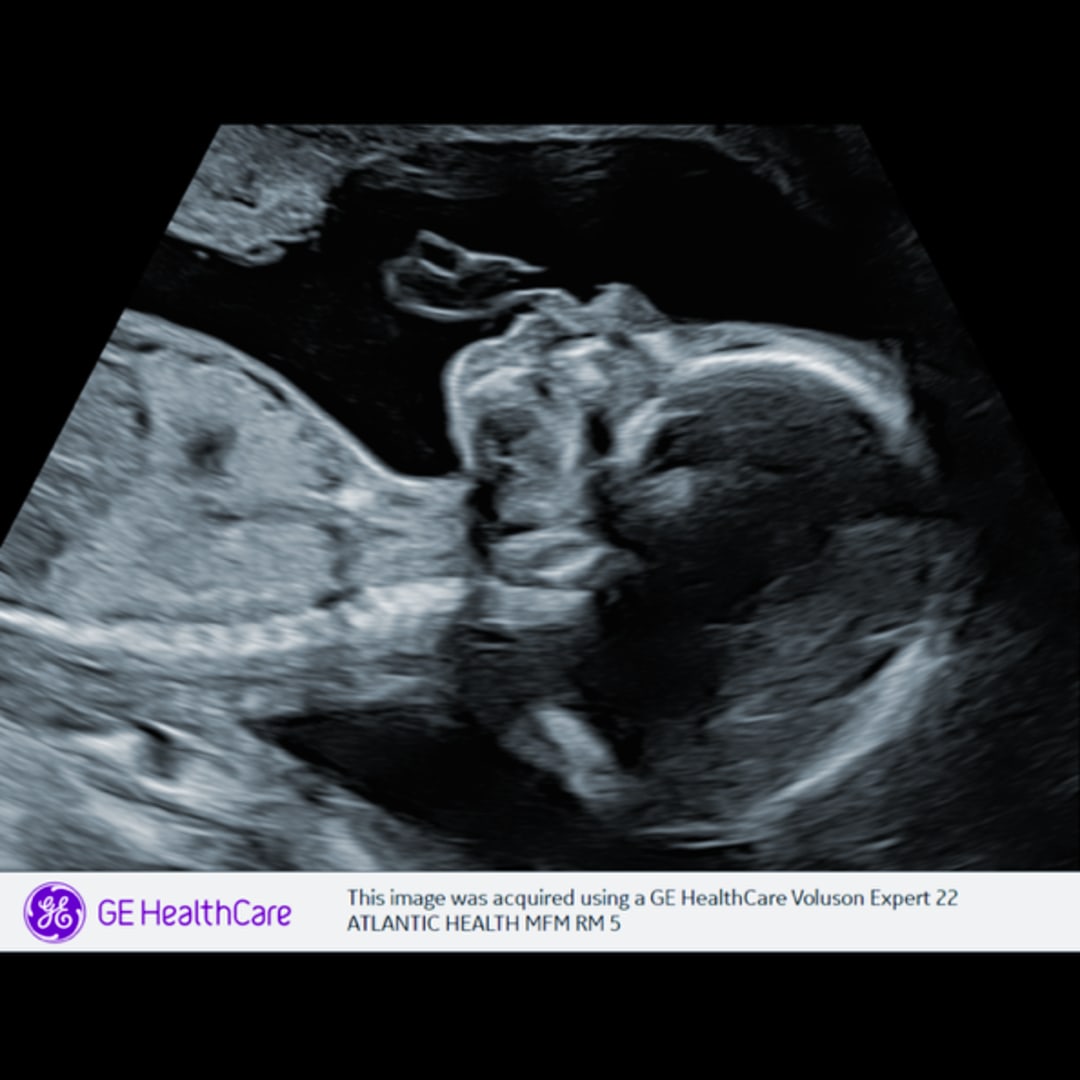 Photo shared by Ava for their Babylist baby registry.