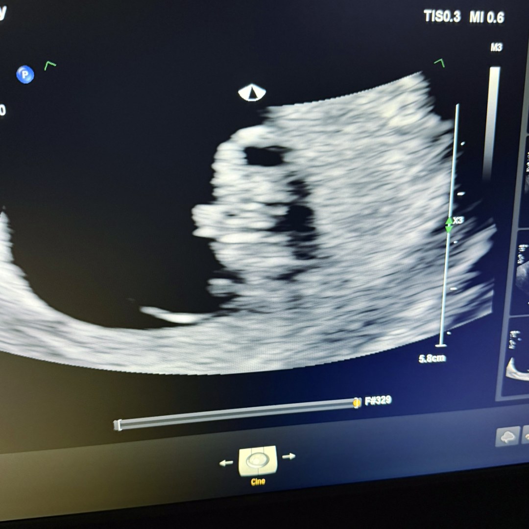 Photo shared by Amanda for their Babylist baby registry.