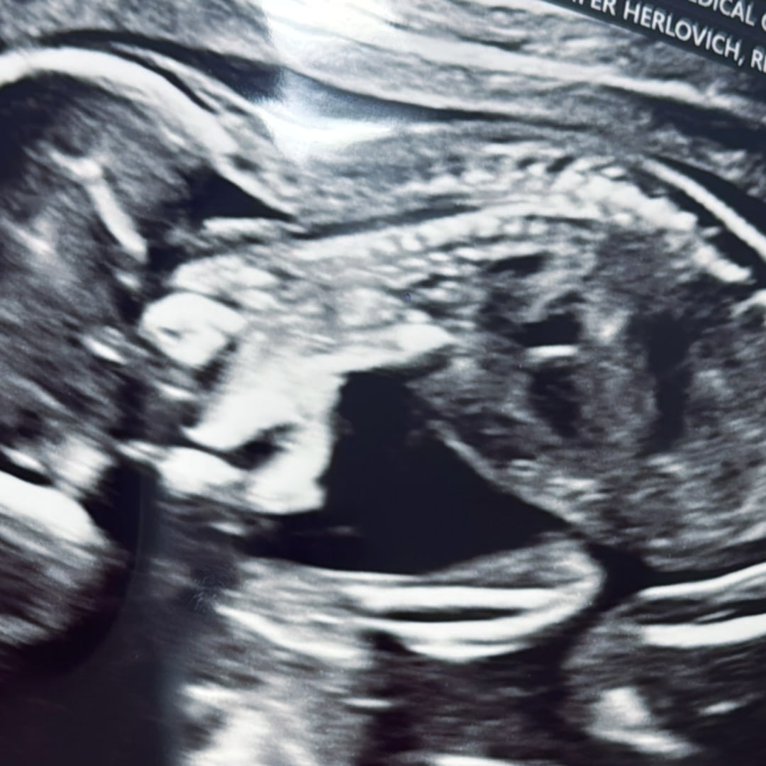 Photo shared by Marisol for their Babylist baby registry.