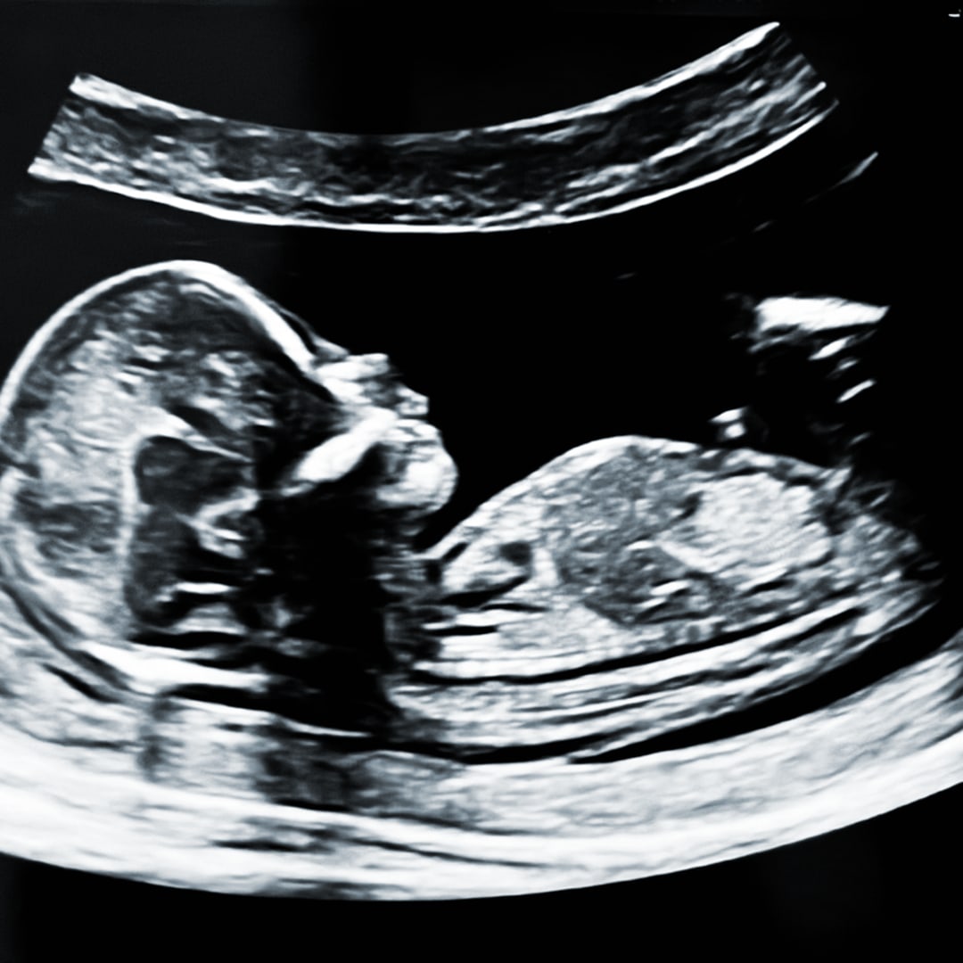 Photo shared by Sydney for their Babylist baby registry.