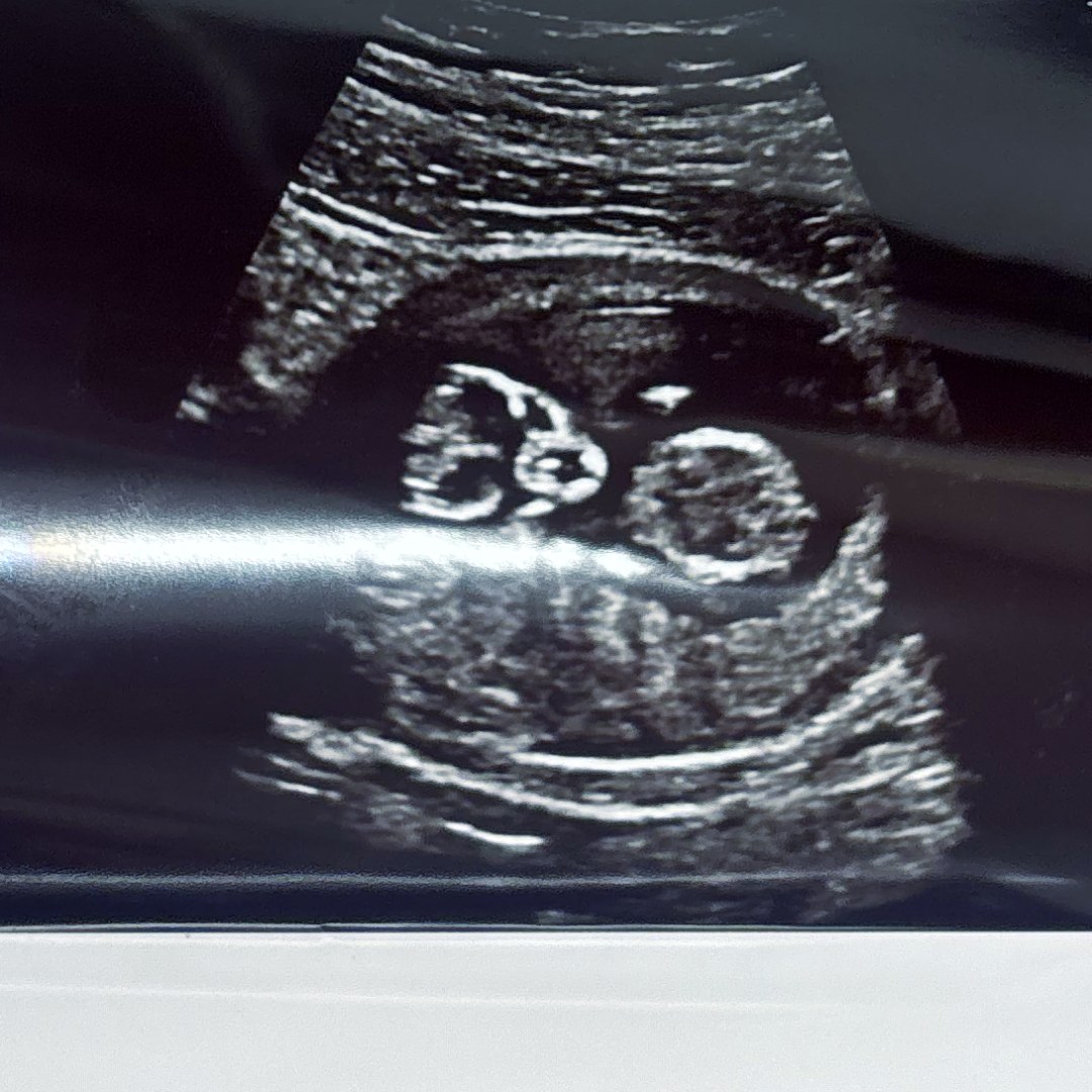 Photo shared by Anaiyah for their Babylist baby registry.