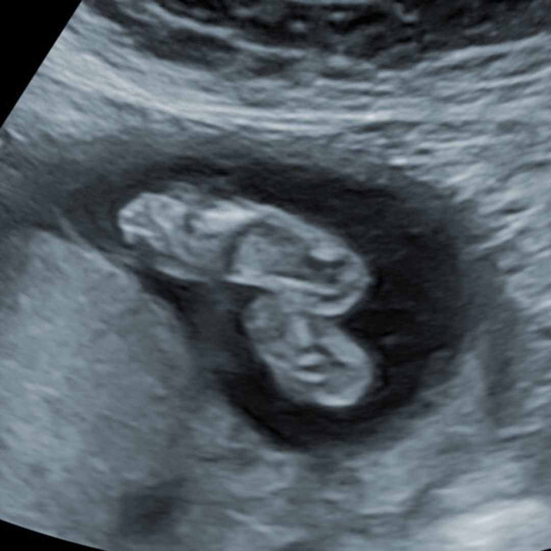 Photo shared by Elizabeth for their Babylist baby registry.