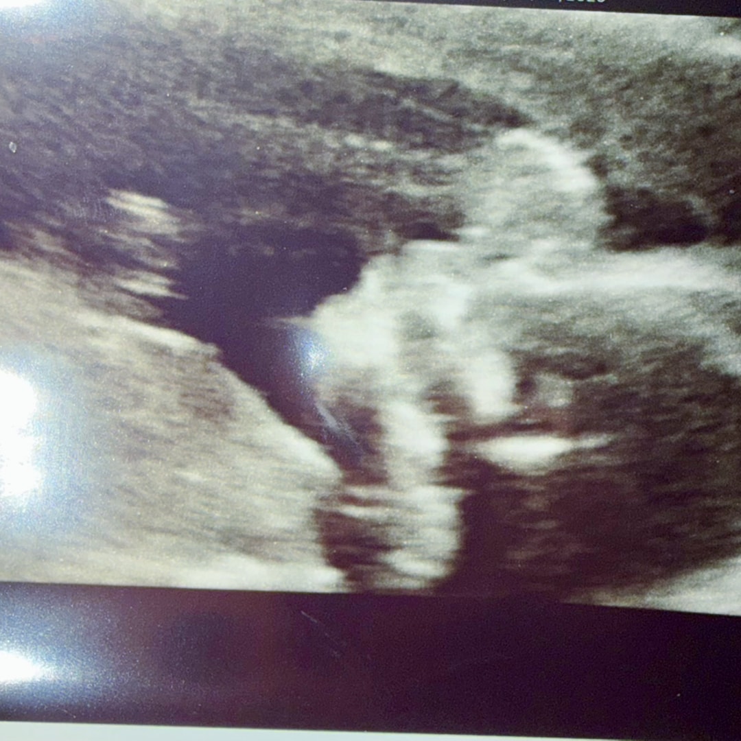Photo shared by Elani for their Babylist baby registry.