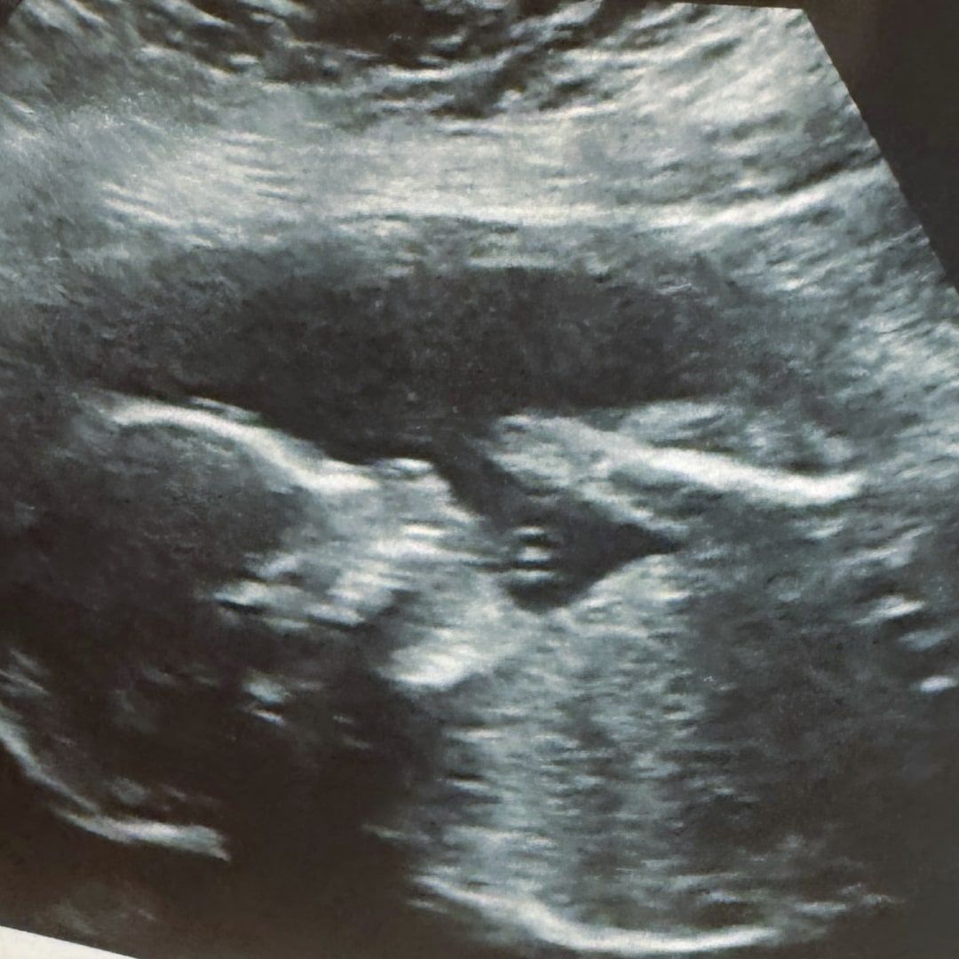 Photo shared by Caitlin for their Babylist baby registry.