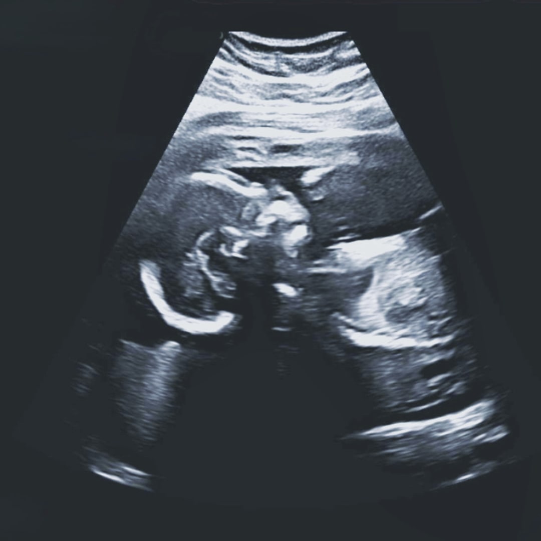 Photo shared by Elshu for their Babylist baby registry.