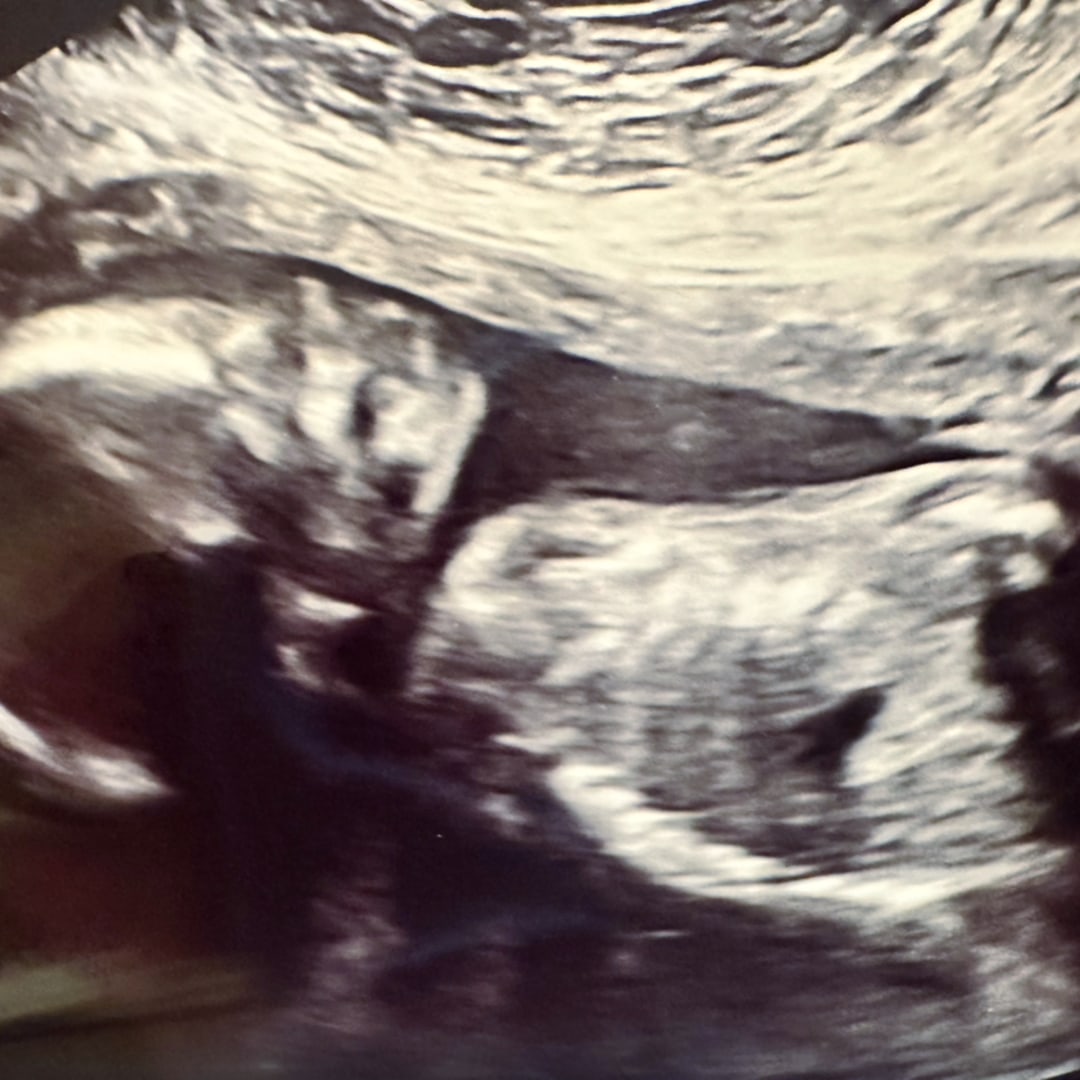 Photo shared by Peyton for their Babylist baby registry.