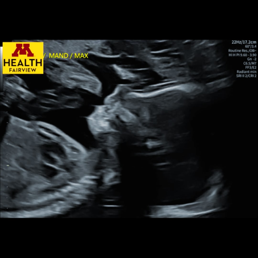 Photo shared by Molly for their Babylist baby registry.