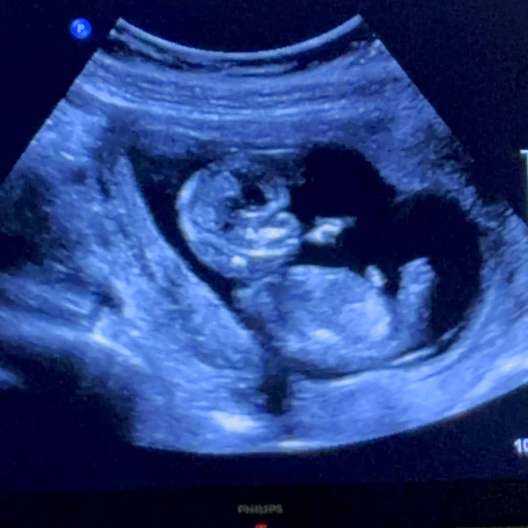 Photo shared by Corrie for their Babylist baby registry.