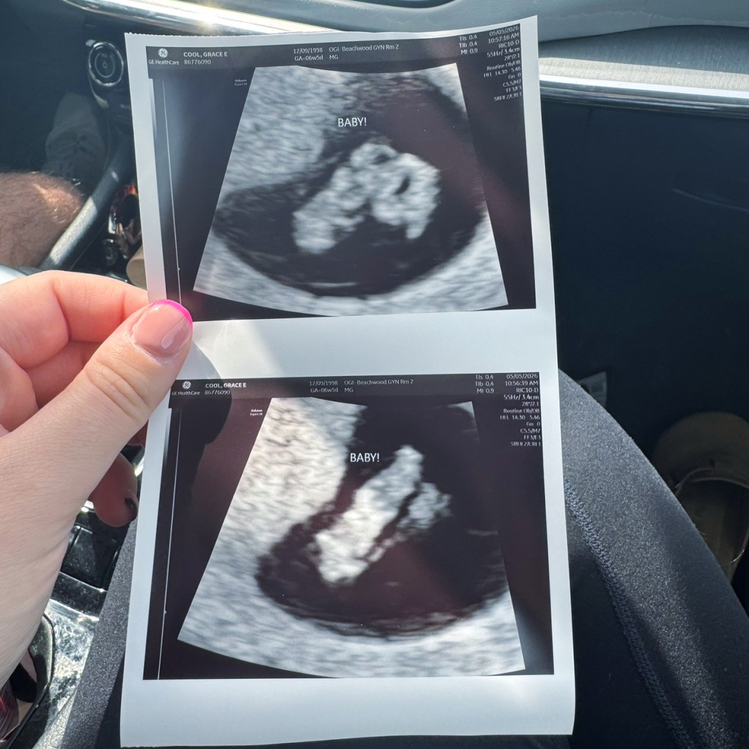 Photo shared by Grace for their Babylist baby registry.