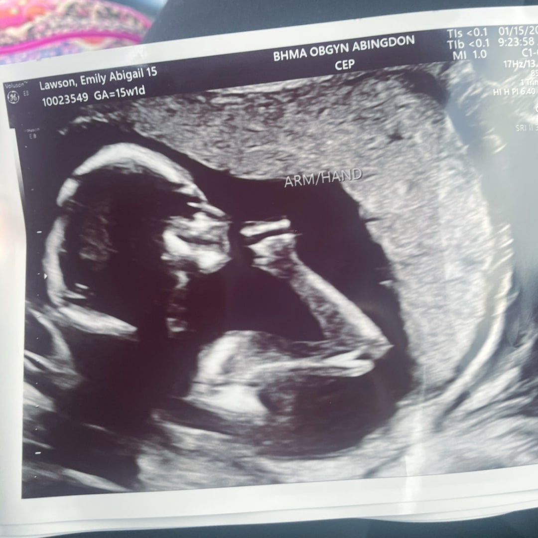 Photo shared by Emily for their Babylist baby registry.