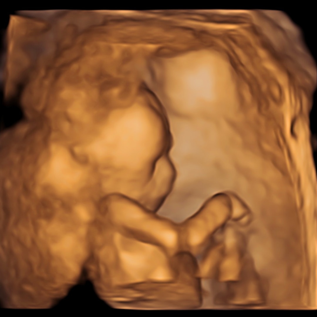 Photo shared by Deyana for their Babylist baby registry.