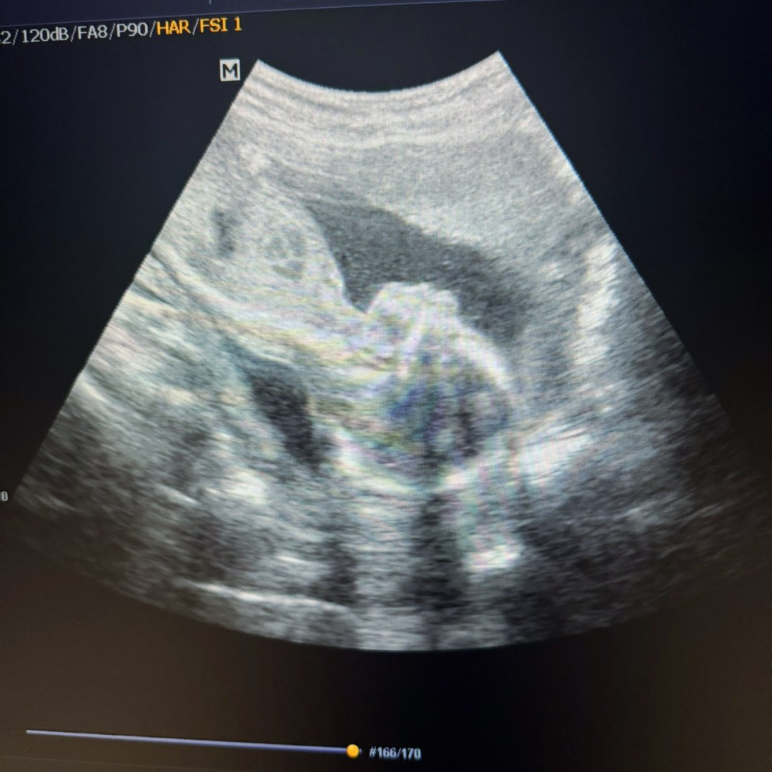 Photo shared by Jeff for their Babylist baby registry.