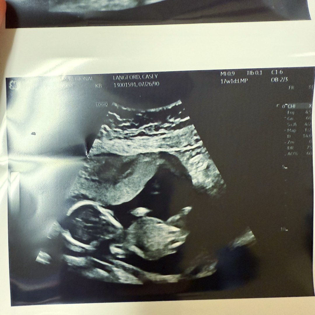 Photo shared by Casey for their Babylist baby registry.