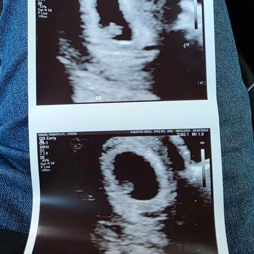 Photo shared by Tee for their Babylist baby registry.