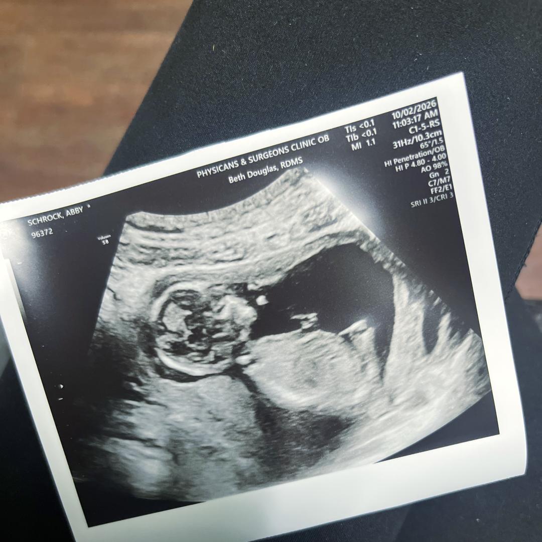 Photo shared by Abby for their Babylist baby registry.