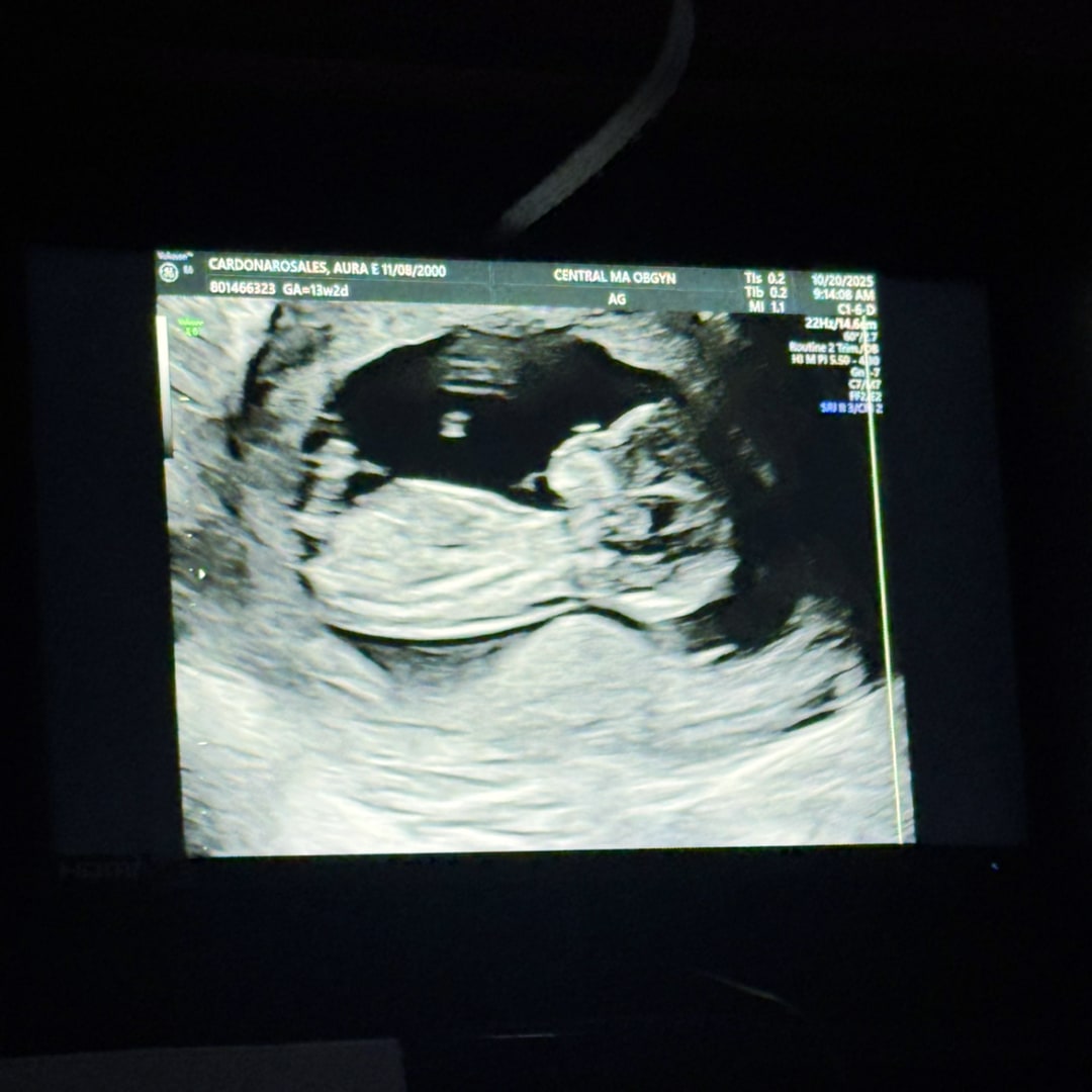 Photo shared by Aura for their Babylist baby registry.