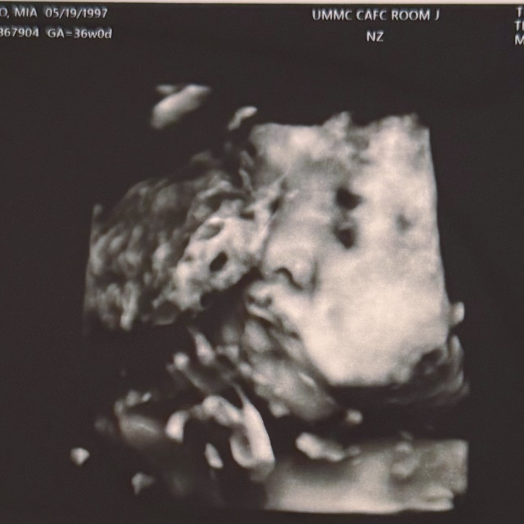 Photo shared by Mia for their Babylist baby registry.