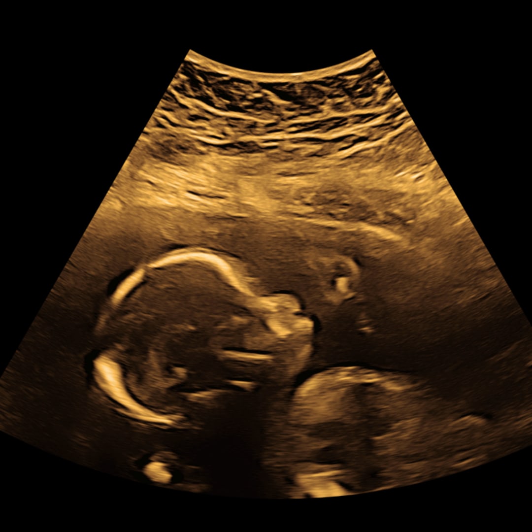 Photo shared by Jasmine for their Babylist baby registry.